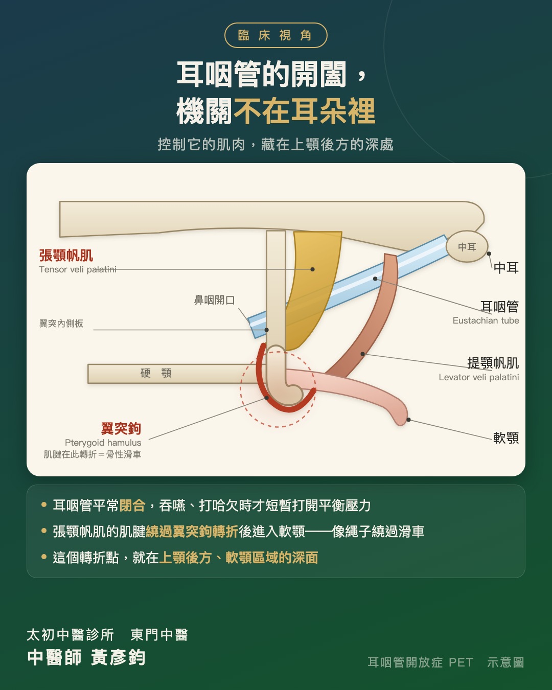 耳朵裡那扇關不緊的門－從解剖重新挖線索，處理耳咽管開放症