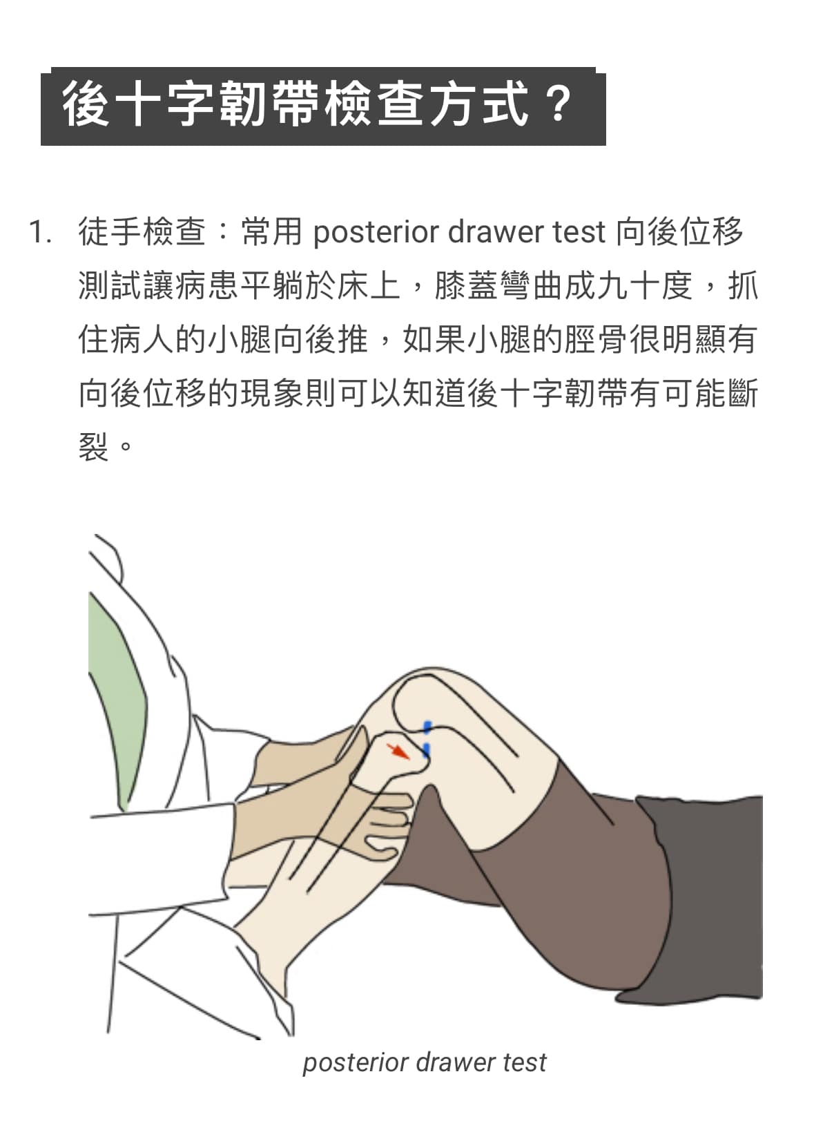 會做一點簡單PE還是很重要的，今天就這樣撈到一個PCL有問題的患者🤨
