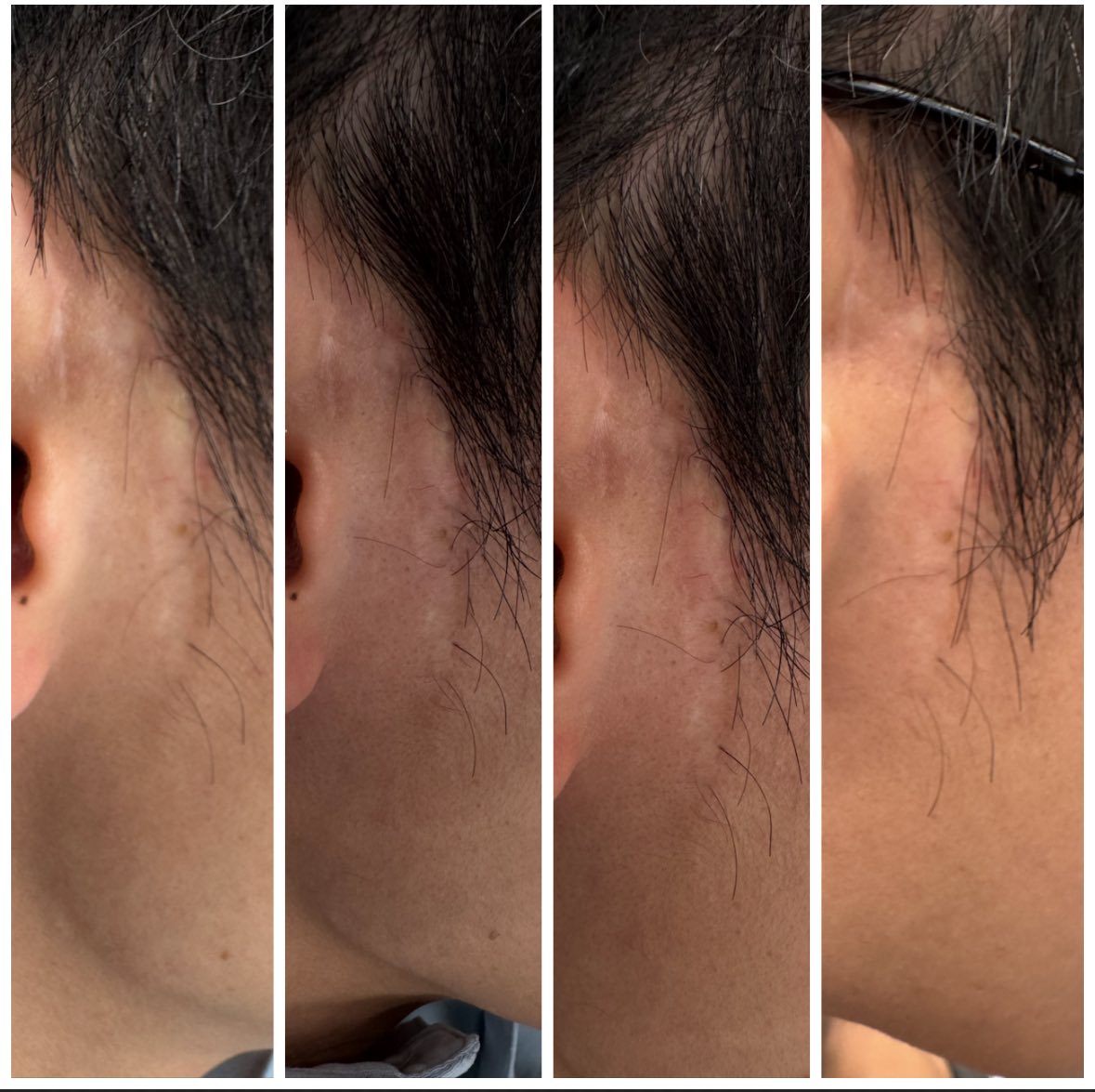 Scar work day4
