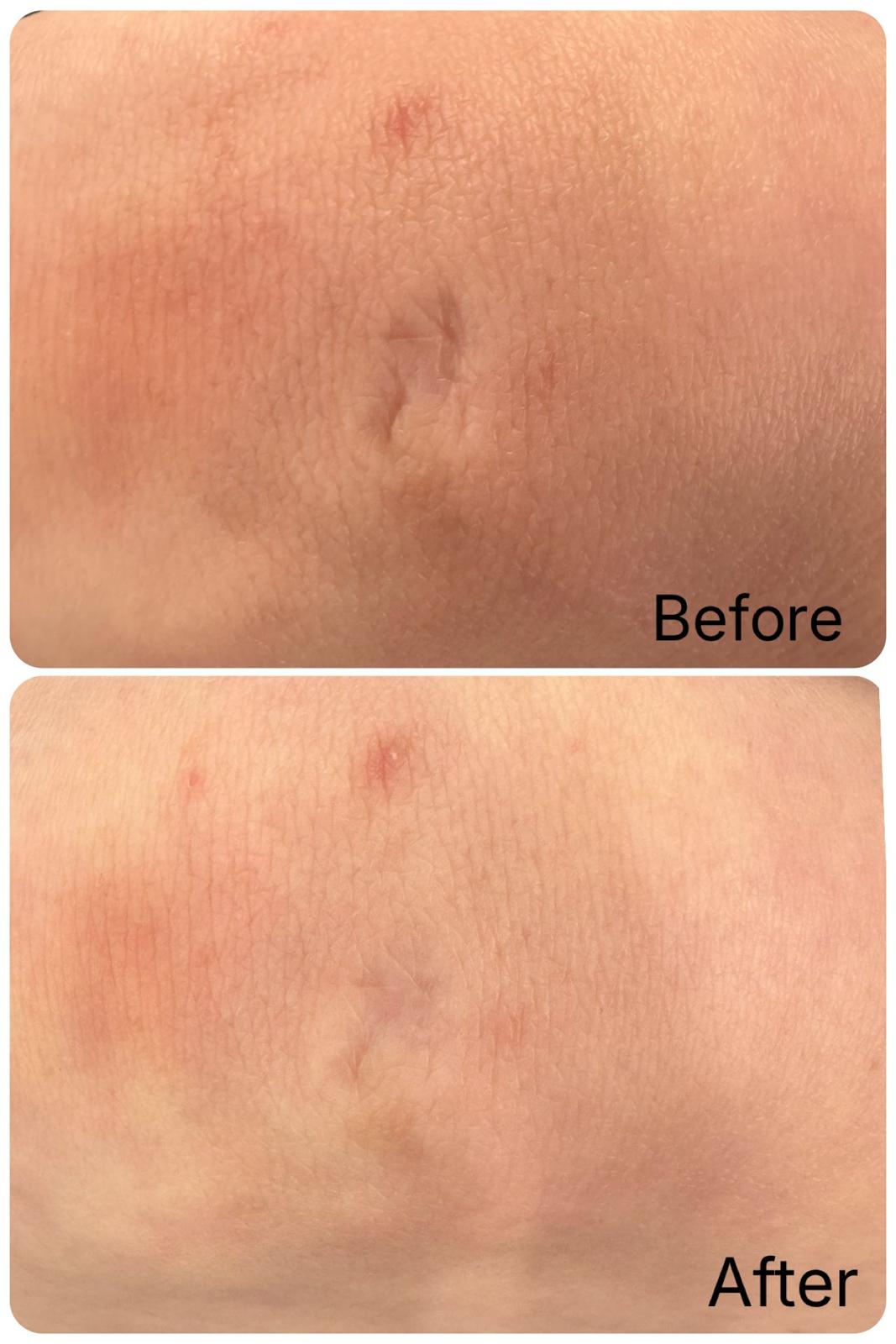 Scar work day4