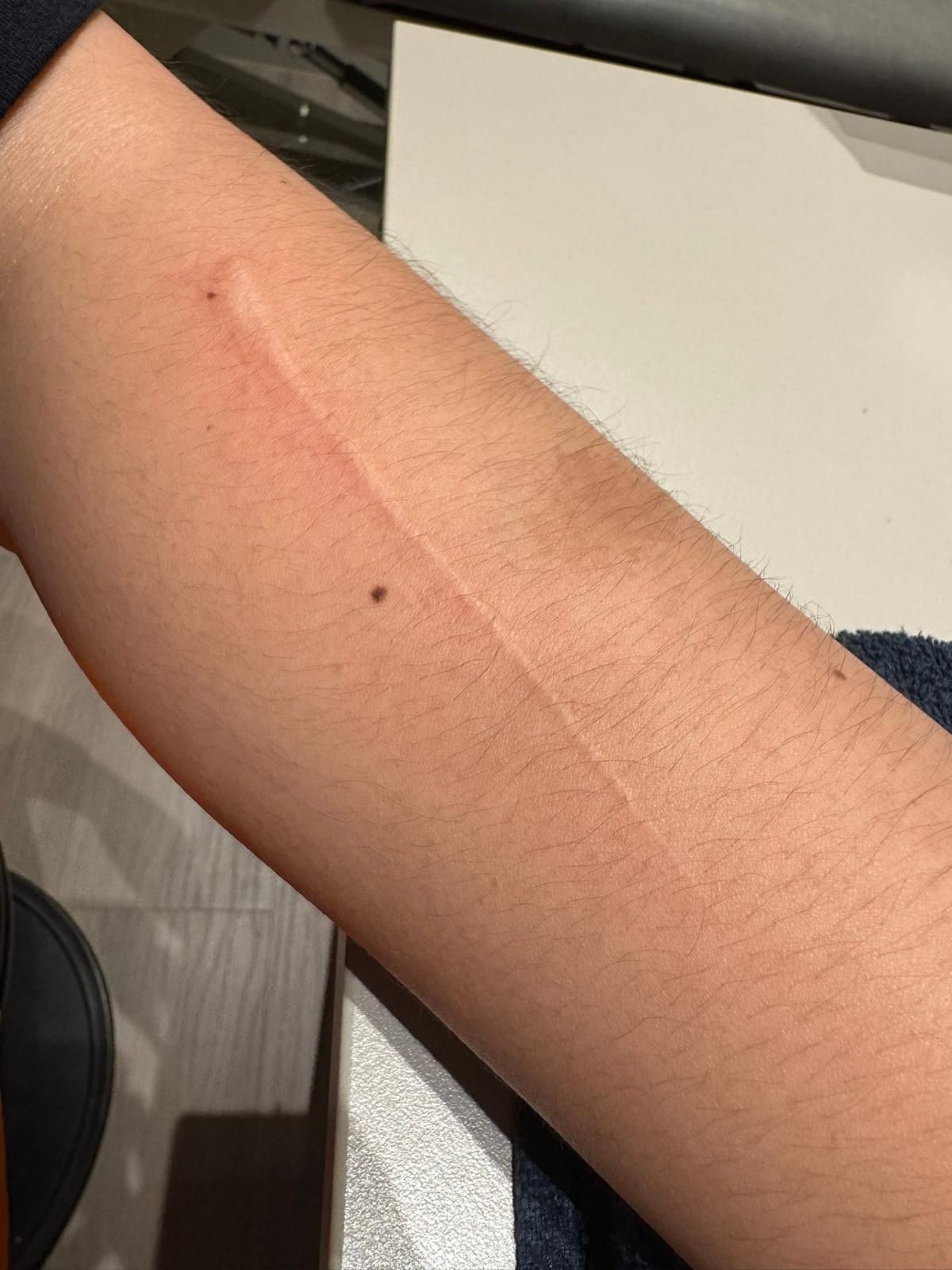 沒去學過Scarwork，真的完全不會有今天！