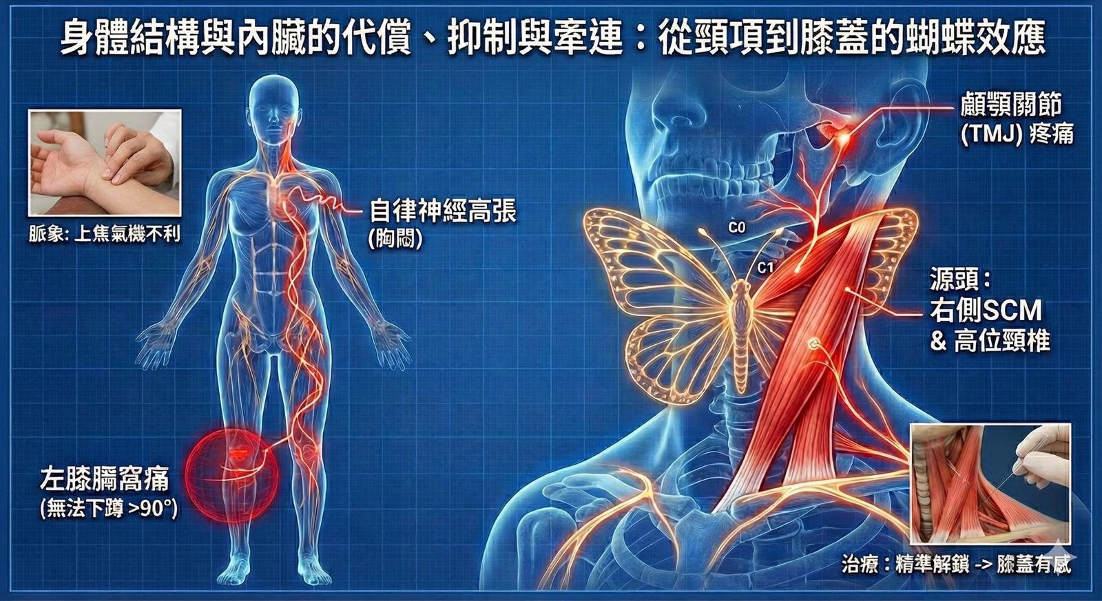 身體結構與內臟的代償、抑制與牽連 (2)：從顳顎到膝膕－胸鎖乳突肌的遠端蝴蝶效應