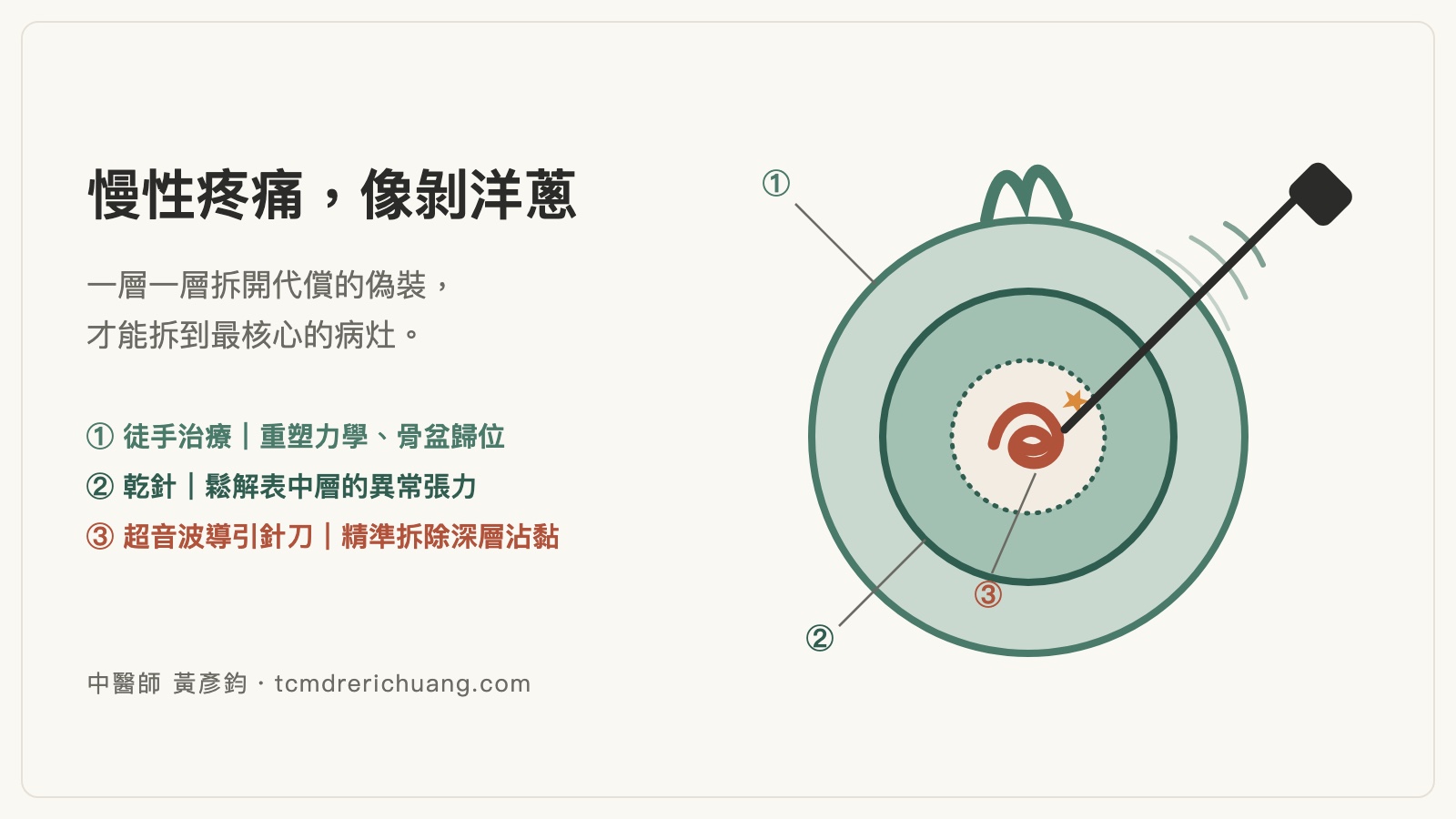當骨骼沒壞，問題出在哪？－從徒手解構張力，以超音波導引針刀精準拆彈